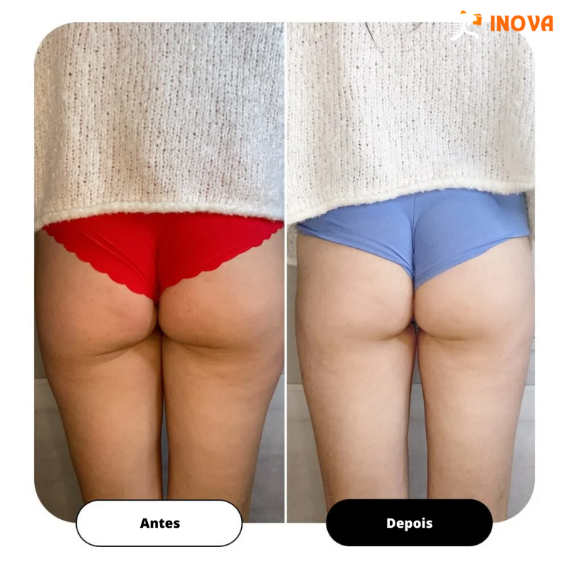 TRANSFORME SEU BUMBUM EM UM SONHO INVEJÁVEL E LIVRE DE CELULITES - Glutes Trainer