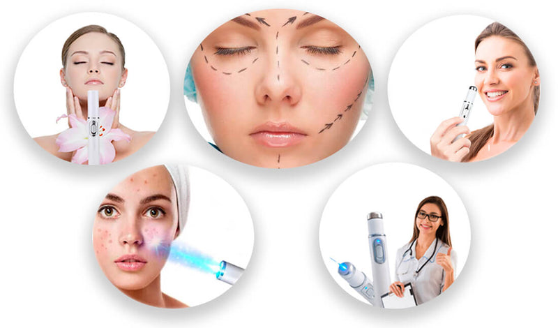 Caneta Laser Tratamento de Varizes e Acne – LaserPen™